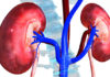 गुर्दे की बीमारी में लाभदायक है भिंडी kidney
