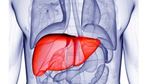 Fatty liver