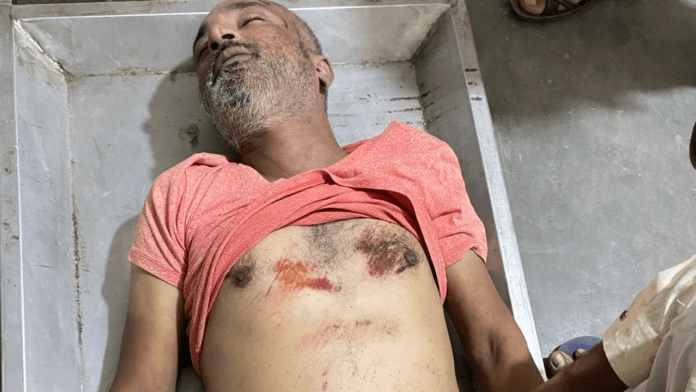 A car rider beat up an e-rickshaw driver